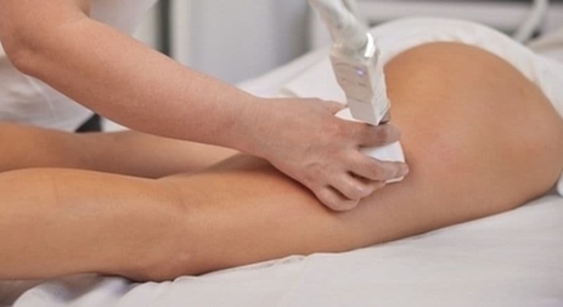 Billet Soin amincissant à Montpellier